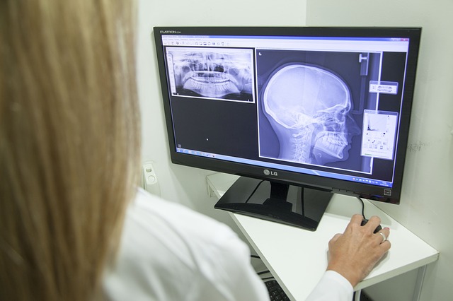 AI in x-ray: Don’t trust it yet